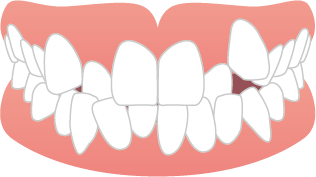 teeth_item