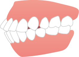 teeth_item