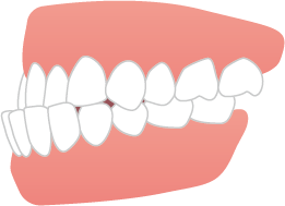 teeth_item