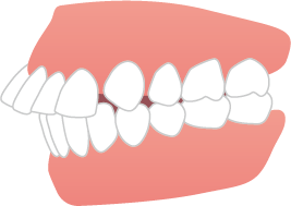 teeth_item