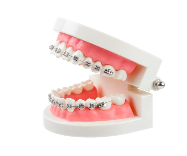 item03